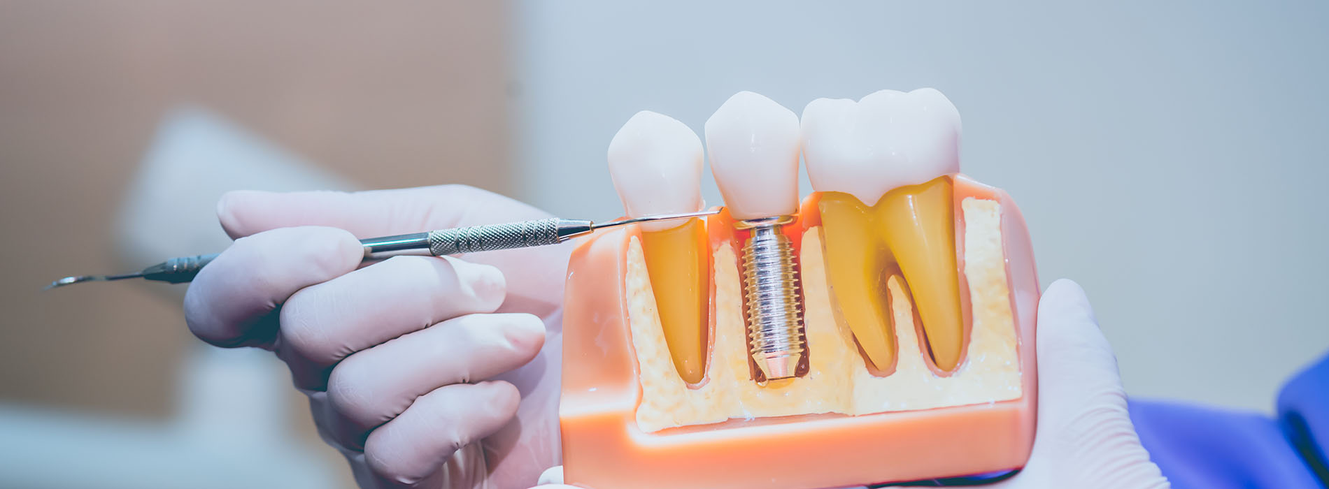 The image shows a person s hand holding a dental tool over a model set of teeth, indicating a dental or oral health context.