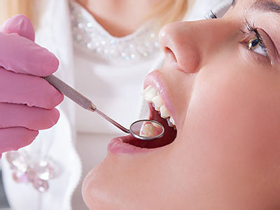 A dental professional performing a cleaning procedure on a patient s teeth.